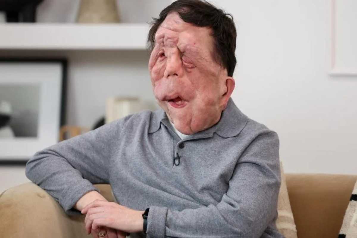 intervista ad Adam Pearson
