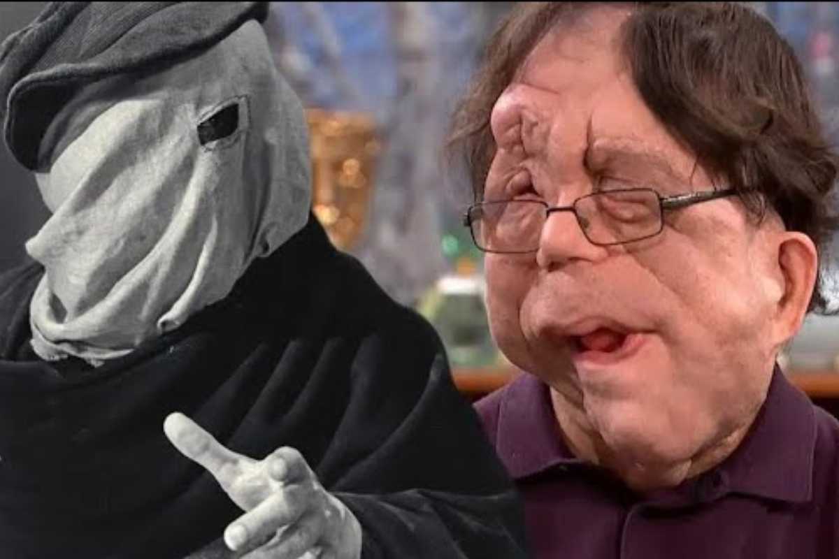 Adam Pearson in un film