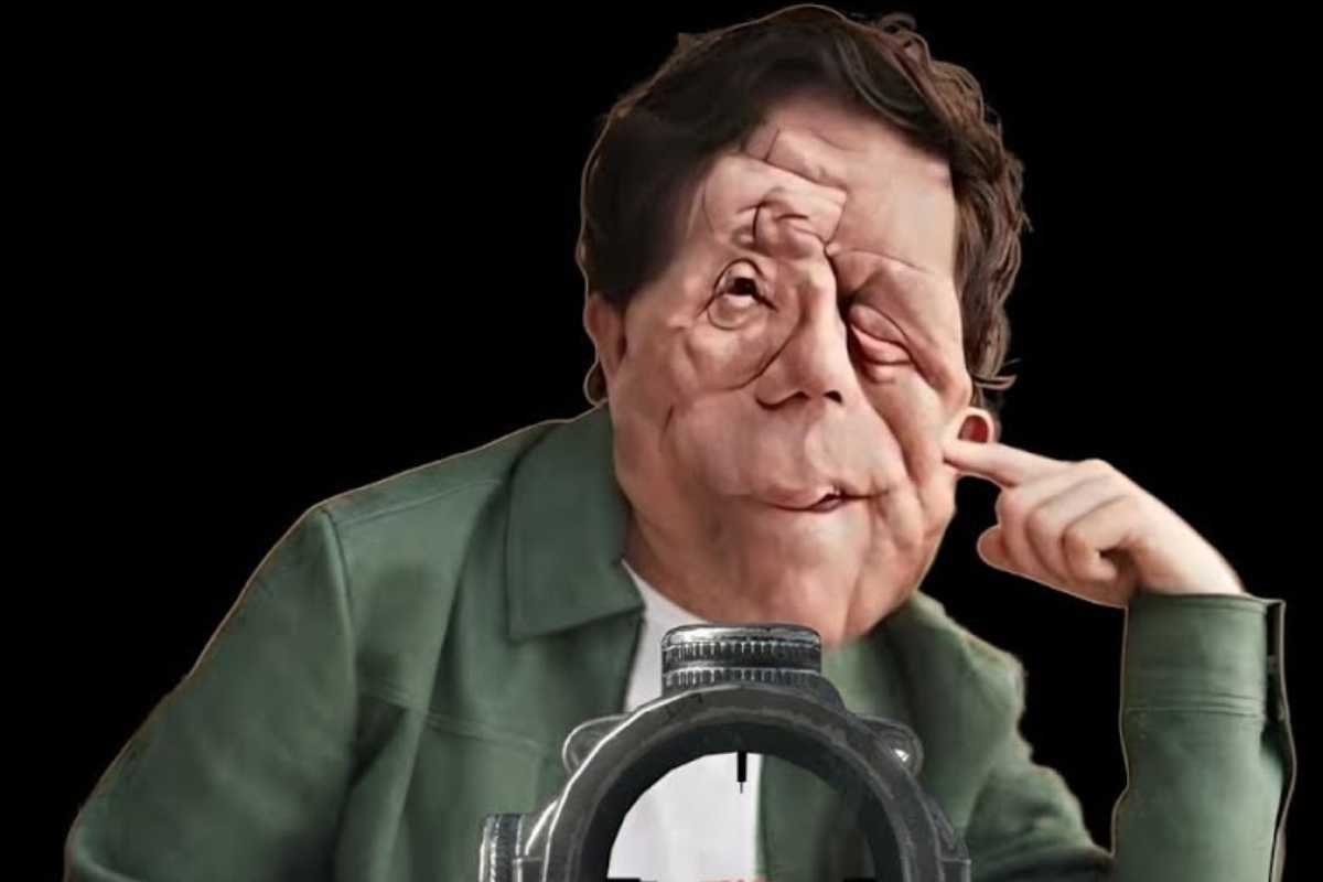The Elephant Man, a giugno nelle sale il remake: l’attore è affetto da neurofibromatosi